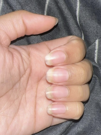 Before image